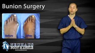 What To Expect After Bunion Surgery [upl. by Marion]