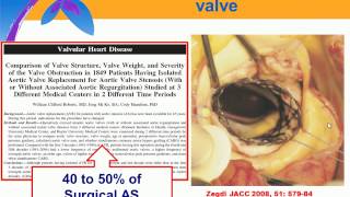 Periprocedural guidance and detection of complications in TAVI [upl. by Jermain901]