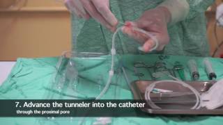 TK Catheter insertion for peritoneal dialysis by nephrologist [upl. by Onafets]