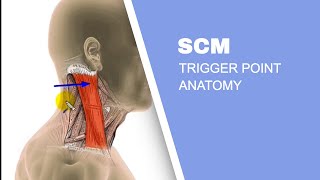 Sternocleidomastoid Muscle SCM Trigger Points [upl. by Waldon724]