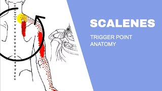 Scalenes Trigger Points [upl. by Eilyr740]