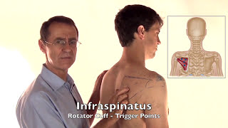 Trigger Point Release  Infraspinatus Muscle [upl. by Anelat]